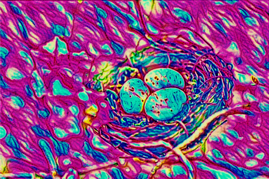 THE BIRD'S NEST - An Original Vibrant Colorful Pink Bird's Nest with Three Blue Eggs Home Impressionistic Wall Artwork Print by ElaniArt