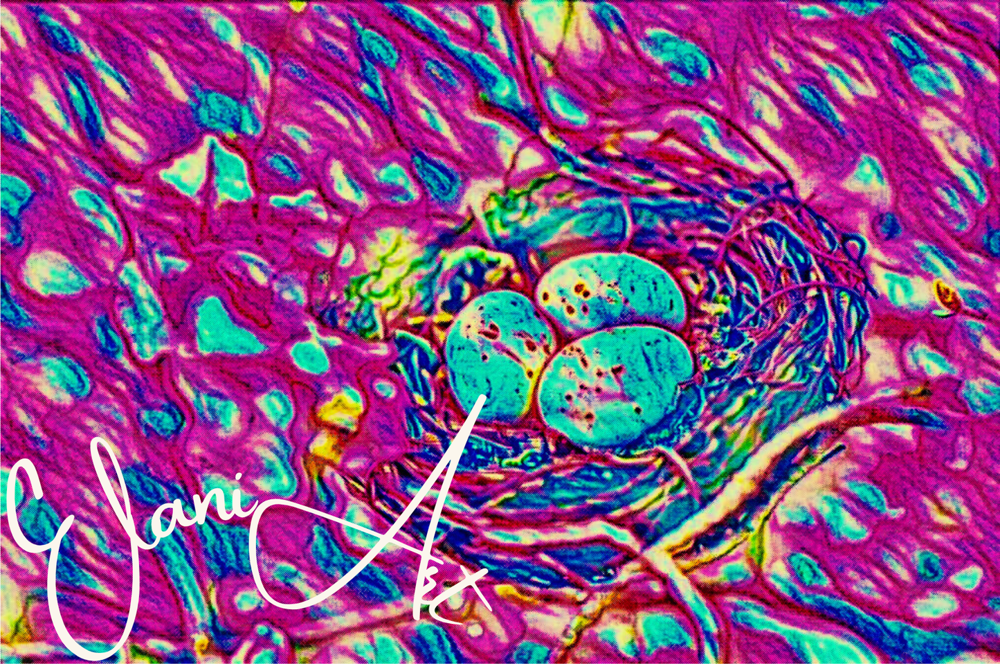 THE BIRD'S NEST - An Original Vibrant Colorful Pink Bird's Nest with Three Blue Eggs Home Impressionistic Wall Artwork Print by ElaniArt